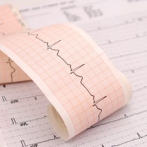 EKG Near Me in Columbus, OH