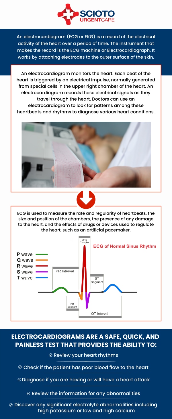 Common questions asked by patients: What can an EKG test detect? What is the difference between ECG and EKG? Why would I need an EKG? How accurate is an EKG test? How often should I have an EKG? How much does an EKG cost? Urgent care with EKG (Electrocardiogram) is available at Scioto Urgent Care in Columbus, OH, under the care of Dr. William Rothe, M.D. Our experienced team provides quick and accurate EKG tests to diagnose potential heart conditions and ensure your well-being. If you're experiencing symptoms such as chest pain, dizziness, or other concerning signs, we are here to provide immediate care and support. For more information, contact us now or book an appointment. We are conveniently located at 4760 Sawmill Road Columbus, OH 43235. We serve patients from Columbus OH, Dublin OH, Upper Arlington OH, Hilliard OH, Worthington OH, and surrounding areas. Common questions asked by patients: What can an EKG test detect? What is the difference between ECG and EKG? Why would I need an EKG? How accurate is an EKG test? How often should I have an EKG? How much does an EKG cost?
Urgent care with EKG (Electrocardiogram) is available at Scioto Urgent Care in Columbus, OH, under the care of Dr. William Rothe, M.D. Our experienced team provides quick and accurate EKG tests to diagnose potential heart conditions and ensure your well-being. If you're experiencing symptoms such as chest pain, dizziness, or other concerning signs, we are here to provide immediate care and support. For more information, contact us now or book an appointment. We are conveniently located at 4760 Sawmill Road Columbus, OH 43235. We serve patients from Columbus OH, Dublin OH, Upper Arlington OH, Hilliard OH, Worthington OH, and surrounding areas.