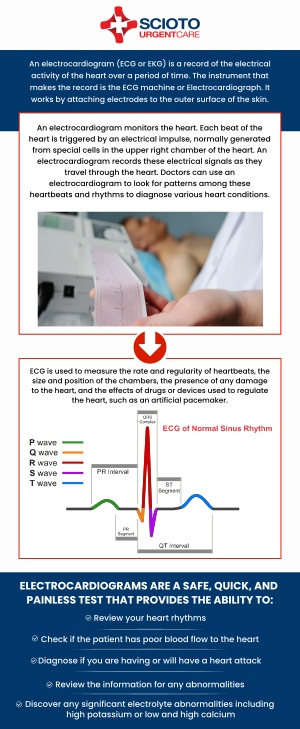 Common questions asked by patients: What can an EKG test detect? What is the difference between ECG and EKG? Why would I need an EKG? How accurate is an EKG test? How often should I have an EKG? How much does an EKG cost? Urgent care with EKG (Electrocardiogram) is available at Scioto Urgent Care in Columbus, OH, under the care of Dr. William Rothe, M.D. Our experienced team provides quick and accurate EKG tests to diagnose potential heart conditions and ensure your well-being. If you're experiencing symptoms such as chest pain, dizziness, or other concerning signs, we are here to provide immediate care and support. For more information, contact us now or book an appointment. We are conveniently located at 4760 Sawmill Road Columbus, OH 43235. We serve patients from Columbus OH, Dublin OH, Upper Arlington OH, Hilliard OH, Worthington OH, and surrounding areas. Common questions asked by patients: What can an EKG test detect? What is the difference between ECG and EKG? Why would I need an EKG? How accurate is an EKG test? How often should I have an EKG? How much does an EKG cost?
Urgent care with EKG (Electrocardiogram) is available at Scioto Urgent Care in Columbus, OH, under the care of Dr. William Rothe, M.D. Our experienced team provides quick and accurate EKG tests to diagnose potential heart conditions and ensure your well-being. If you're experiencing symptoms such as chest pain, dizziness, or other concerning signs, we are here to provide immediate care and support. For more information, contact us now or book an appointment. We are conveniently located at 4760 Sawmill Road Columbus, OH 43235. We serve patients from Columbus OH, Dublin OH, Upper Arlington OH, Hilliard OH, Worthington OH, and surrounding areas.
