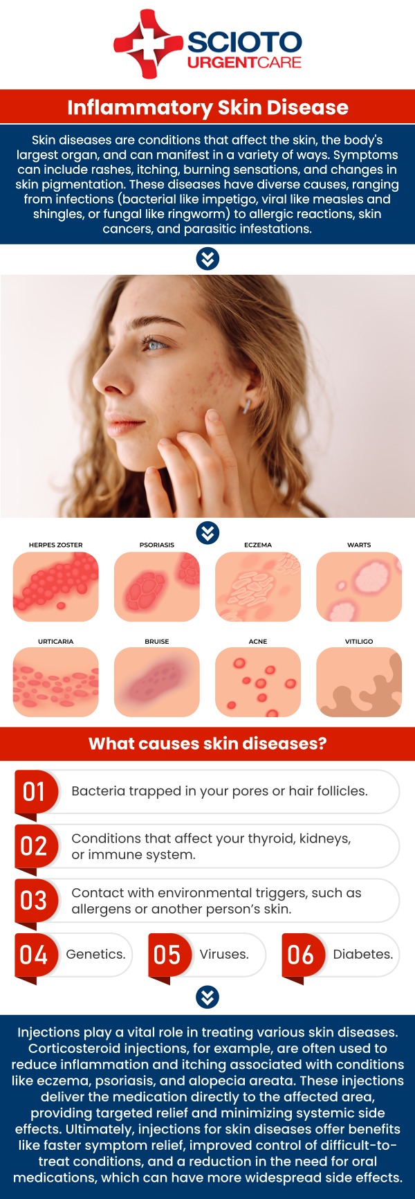 Common questions asked by patients: What is a skin infection? What are the common causes of skin infections? What are the symptoms of a skin infection? How are skin infections treated? When should I see a doctor for a skin infection? A skin infection occurs when bacteria, viruses, or fungi invade the skin, causing symptoms like redness, swelling, and pain. These infections can range from mild conditions, like rashes, to more severe ones, such as cellulitis. Dr. William Rothe, M.D., at Scioto Urgent Care provides expert care, offering treatments with medications and proper wound care to prevent complications. For more information, contact us now or book an appointment. We are conveniently located at 4760 Sawmill Road Columbus, OH 43235. We serve patients from Columbus OH, Dublin OH, Upper Arlington OH, Hilliard OH, Worthington OH, and surrounding areas. Common questions asked by patients: What is a skin infection? What are the common causes of skin infections? What are the symptoms of a skin infection? How are skin infections treated? When should I see a doctor for a skin infection?
A skin infection occurs when bacteria, viruses, or fungi invade the skin, causing symptoms like redness, swelling, and pain. These infections can range from mild conditions, like rashes, to more severe ones, such as cellulitis. Dr. William Rothe, M.D., at Scioto Urgent Care provides expert care, offering treatments with medications and proper wound care to prevent complications. For more information, contact us now or book an appointment. We are conveniently located at 4760 Sawmill Road Columbus, OH 43235. We serve patients from Columbus OH, Dublin OH, Upper Arlington OH, Hilliard OH, Worthington OH, and surrounding areas.
