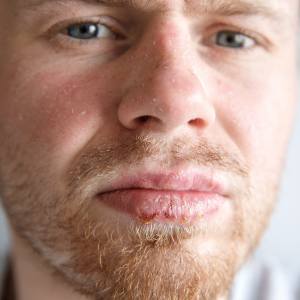 Skin Infection Treatment Near Me in Columbus, OH