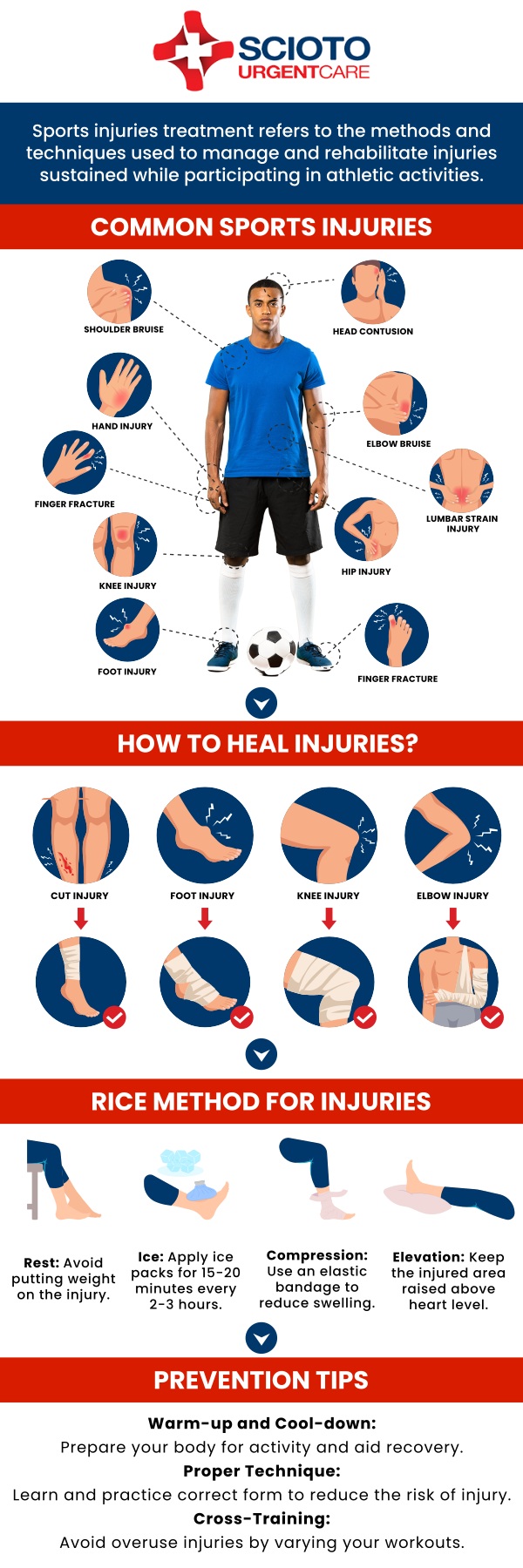 Common questions asked by patients: What common sports injuries do you treat? How long will sports injury treatment take? What are the common types of sports injuries? What causes sports injuries? How can sports injuries be prevented? When should I seek medical care for a sports injury? Sports injuries can occur from accidents, poor training practices, improper gear, or overuse of muscles and joints. Common issues include sprains, strains, fractures, and dislocations, which may limit mobility and daily activities. At Scioto Urgent Care, board-certified Dr. William Rothe, M.D., provides thorough evaluations and care to help patients recover and return to activity safely. For more information, contact us now or book an appointment. We are conveniently located at 4760 Sawmill Road Columbus, OH 43235. We serve patients from Columbus OH, Dublin OH, Upper Arlington OH, Hilliard OH, Worthington OH, and surrounding areas. Common questions asked by patients: What common sports injuries do you treat? How long will sports injury treatment take? What are the common types of sports injuries? What causes sports injuries? How can sports injuries be prevented? When should I seek medical care for a sports injury?
Sports injuries can occur from accidents, poor training practices, improper gear, or overuse of muscles and joints. Common issues include sprains, strains, fractures, and dislocations, which may limit mobility and daily activities. At Scioto Urgent Care, board-certified Dr. William Rothe, M.D., provides thorough evaluations and care to help patients recover and return to activity safely. For more information, contact us now or book an appointment. We are conveniently located at 4760 Sawmill Road Columbus, OH 43235. We serve patients from Columbus OH, Dublin OH, Upper Arlington OH, Hilliard OH, Worthington OH, and surrounding areas.