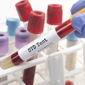 STD Testing Near Me in Columbus, OH