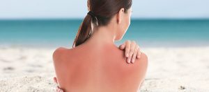 Warm Up to Summer Skin Sunburn Protection! | Scioto Urgent Care Near Me in Columbus, OH Warm Up to Summer Skin Sunburn Protection! | Scioto Urgent Care Near Me in Columbus, OH