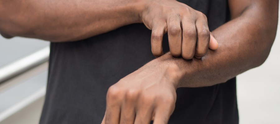 So, You Have a Tick Bite, Now What? | Scioto Urgent Care Near Me in Columbus, OH So, You Have a Tick Bite, Now What? | Scioto Urgent Care Near Me in Columbus, OH
