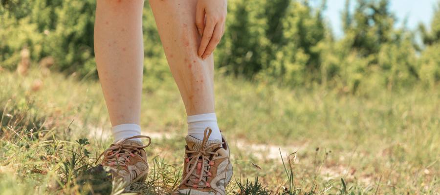 Let’s Talk About Tick Safety! Scioto Urgent Care Near Me in Columbus, OH Let’s Talk About Tick Safety! Scioto Urgent Care Near Me in Columbus, OH