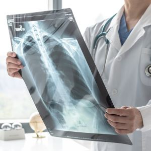 X-Ray Near Me in Columbus, OH