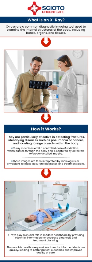 When you have a minor injury like a sprain or a possible fracture, waiting in a hospital emergency room can be a time-consuming and expensive option. At Scioto Urgent Care, we offer the convenience of a walk-in clinic combined with the advanced diagnostic capabilities of on-site X-ray services. Our experienced medical team can quickly and accurately diagnose your condition, provide immediate treatment, and get you on the path to recovery. Skip the long waits and high costs—come to Scioto Urgent Care for fast, efficient, and compassionate care when you need it most. For more information, contact us or schedule an appointment online. We are conveniently located at 4760 Sawmill Road Columbus, OH 43235. When you have a minor injury like a sprain or a possible fracture, waiting in a hospital emergency room can be a time-consuming and expensive option. At Scioto Urgent Care, we offer the convenience of a walk-in clinic combined with the advanced diagnostic capabilities of on-site X-ray services. Our experienced medical team can quickly and accurately diagnose your condition, provide immediate treatment, and get you on the path to recovery. Skip the long waits and high costs—come to Scioto Urgent Care for fast, efficient, and compassionate care when you need it most. For more information, contact us or schedule an appointment online. We are conveniently located at 4760 Sawmill Road Columbus, OH 43235.