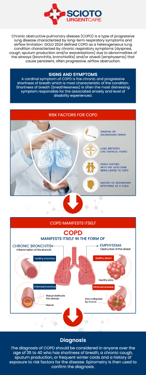 Common questions asked by patients: What is Chronic Obstructive Pulmonary Disease (COPD)? What causes COPD? What are the symptoms of COPD? How is COPD diagnosed? What are the stages of COPD? Chronic Obstructive Pulmonary Disease (COPD) treatment in Columbus, OH, is available at Scioto Urgent Care with Dr. William Rothe, M.D. He offers care to manage COPD symptoms and improve lung function. Dr. Rothe provides personalized treatment plans to help you breathe easier and enhance your quality of life. For more information, contact us now or book an appointment. We are conveniently located at 4760 Sawmill Road Columbus, OH 43235. We serve patients from Columbus OH, Dublin OH, Upper Arlington OH, Hilliard OH, Worthington OH, and surrounding areas. Common questions asked by patients: What is Chronic Obstructive Pulmonary Disease (COPD)? What causes COPD? What are the symptoms of COPD? How is COPD diagnosed? What are the stages of COPD?
Chronic Obstructive Pulmonary Disease (COPD) treatment in Columbus, OH, is available at Scioto Urgent Care with Dr. William Rothe, M.D. He offers care to manage COPD symptoms and improve lung function. Dr. Rothe provides personalized treatment plans to help you breathe easier and enhance your quality of life. For more information, contact us now or book an appointment. We are conveniently located at 4760 Sawmill Road Columbus, OH 43235. We serve patients from Columbus OH, Dublin OH, Upper Arlington OH, Hilliard OH, Worthington OH, and surrounding areas.