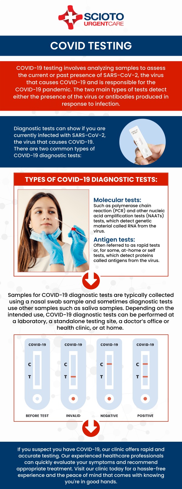 Common questions asked by patients: How is a COVID-19 test performed? How long does it take to get COVID-19 test results? Are COVID-19 tests covered by insurance? How long are you contagious after you test positive for COVID-19? Where can I get a COVID-19 test in Columbus, Ohio? COVID-19 testing in Columbus, OH, is offered at Scioto Urgent Care with our board-certified Dr. William Rothe, M.D. We provide fast and reliable PCR and rapid tests, ensuring accurate results with quick turnaround times. Trust our team to help you stay safe and informed. For more information, contact us now or book an appointment. We are conveniently located at 4760 Sawmill Road Columbus, OH 43235. We serve patients from Columbus OH, Dublin OH, Upper Arlington OH, Hilliard OH, Worthington OH, and surrounding areas. Common questions asked by patients: How is a COVID-19 test performed? How long does it take to get COVID-19 test results? Are COVID-19 tests covered by insurance? How long are you contagious after you test positive for COVID-19? Where can I get a COVID-19 test in Columbus, Ohio?
COVID-19 testing in Columbus, OH, is offered at Scioto Urgent Care with our board-certified Dr. William Rothe, M.D. We provide fast and reliable PCR and rapid tests, ensuring accurate results with quick turnaround times. Trust our team to help you stay safe and informed. For more information, contact us now or book an appointment. We are conveniently located at 4760 Sawmill Road Columbus, OH 43235. We serve patients from Columbus OH, Dublin OH, Upper Arlington OH, Hilliard OH, Worthington OH, and surrounding areas.