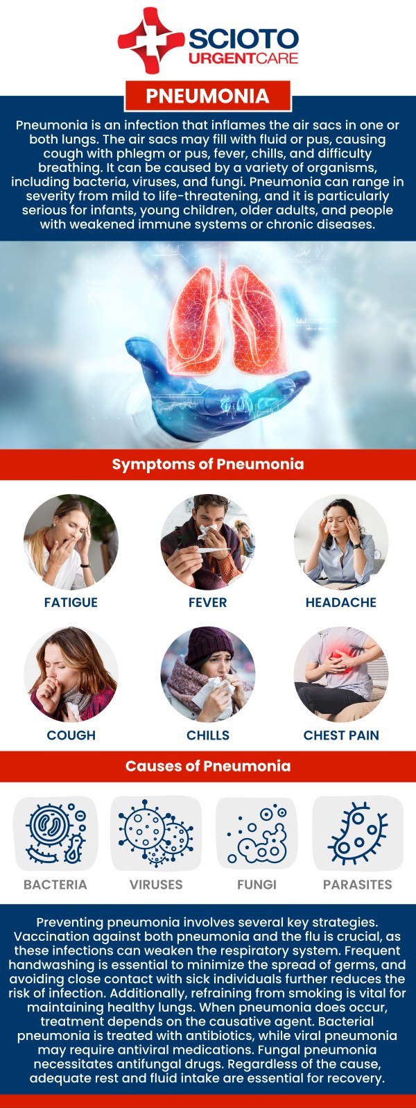 Common questions asked by patients: What is pneumonia? What causes pneumonia? What are the symptoms of pneumonia? How is pneumonia diagnosed? Is pneumonia contagious? How long does it take to recover from pneumonia? Pneumonia is a lung infection that can cause cough, fever, chest pain, and difficulty breathing, ranging from mild to severe. At Scioto Urgent Care, board-certified doctor Dr. William Rothe, M.D., provides thorough evaluation and treatment to support your recovery. For more information, contact us now or book an appointment. We are conveniently located at 4760 Sawmill Road Columbus, OH 43235. We serve patients from Columbus OH, Dublin OH, Upper Arlington OH, Hilliard OH, Worthington OH, and surrounding areas. Common questions asked by patients: What is pneumonia? What causes pneumonia? What are the symptoms of pneumonia? How is pneumonia diagnosed? Is pneumonia contagious? How long does it take to recover from pneumonia?
Pneumonia is a lung infection that can cause cough, fever, chest pain, and difficulty breathing, ranging from mild to severe. At Scioto Urgent Care, board-certified doctor Dr. William Rothe, M.D., provides thorough evaluation and treatment to support your recovery. For more information, contact us now or book an appointment. We are conveniently located at 4760 Sawmill Road Columbus, OH 43235. We serve patients from Columbus OH, Dublin OH, Upper Arlington OH, Hilliard OH, Worthington OH, and surrounding areas.