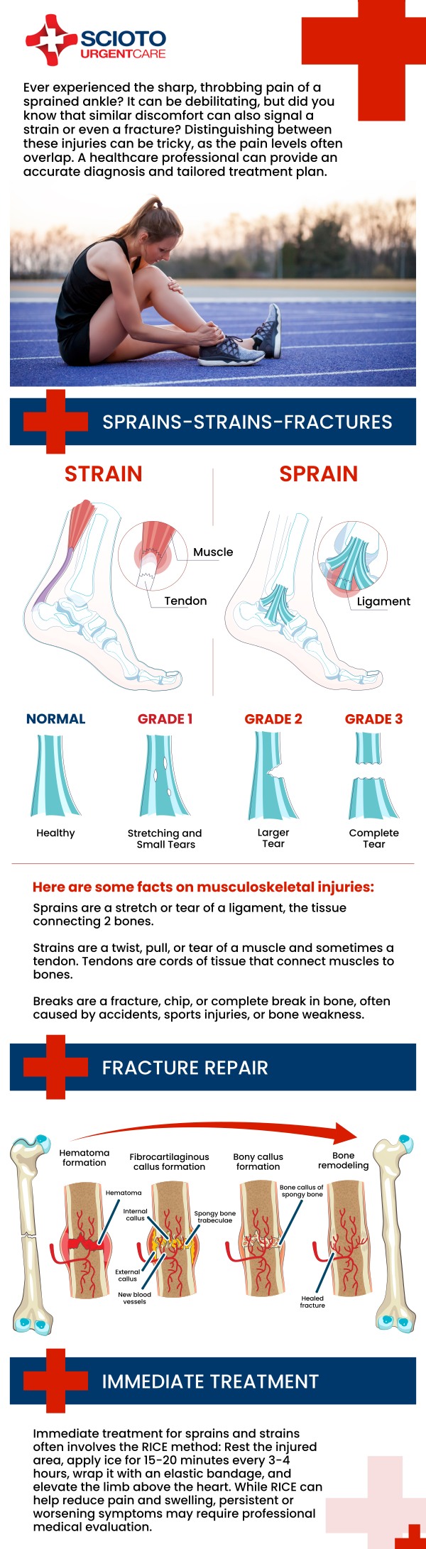 Common questions asked by patients: What are sprains and strains? What causes sprains and strains? What are the symptoms of sprains and strains? How are sprains and strains diagnosed? Sprains and strains are common injuries that affect muscles, ligaments, and tendons, often caused by sudden twists, falls, or overuse during physical activity. Proper diagnosis and timely care are important to reduce pain and prevent further damage. In Columbus, OH, Board-Certified Dr. William Rothe, M.D., at Scioto Urgent Care provides thorough evaluation and treatment to help patients recover safely and regain mobility. For more information, contact us now or book an appointment. We are conveniently located at 4760 Sawmill Road Columbus, OH 43235. We serve patients from Columbus OH, Dublin OH, Upper Arlington OH, Hilliard OH, Worthington OH, and surrounding areas. Common questions asked by patients: What are sprains and strains? What causes sprains and strains? What are the symptoms of sprains and strains? How are sprains and strains diagnosed?
Sprains and strains are common injuries that affect muscles, ligaments, and tendons, often caused by sudden twists, falls, or overuse during physical activity. Proper diagnosis and timely care are important to reduce pain and prevent further damage. In Columbus, OH, Board-Certified Dr. William Rothe, M.D., at Scioto Urgent Care provides thorough evaluation and treatment to help patients recover safely and regain mobility. For more information, contact us now or book an appointment. We are conveniently located at 4760 Sawmill Road Columbus, OH 43235. We serve patients from Columbus OH, Dublin OH, Upper Arlington OH, Hilliard OH, Worthington OH, and surrounding areas.
