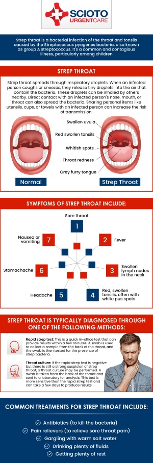 Common questions asked by patients: What is strep throat? What are the common symptoms of strep throat? How is strep throat diagnosed? When should I see a doctor for a sore throat? How is strep throat treated? Is strep throat contagious? Strep throat is a bacterial infection that causes pain, redness, and swelling in the throat, often making swallowing difficult. At Scioto Urgent Care, Dr. William Rothe, M.D. provides prompt evaluation, accurate testing, and effective treatment to help relieve discomfort and prevent complications. For more information, contact us now or book an appointment. We are conveniently located at 4760 Sawmill Road Columbus, OH 43235. We serve patients from Columbus OH, Dublin OH, Upper Arlington OH, Hilliard OH, Worthington OH, and surrounding areas. Common questions asked by patients: What is strep throat? What are the common symptoms of strep throat? How is strep throat diagnosed? When should I see a doctor for a sore throat? How is strep throat treated? Is strep throat contagious?
Strep throat is a bacterial infection that causes pain, redness, and swelling in the throat, often making swallowing difficult. At Scioto Urgent Care, Dr. William Rothe, M.D. provides prompt evaluation, accurate testing, and effective treatment to help relieve discomfort and prevent complications. For more information, contact us now or book an appointment. We are conveniently located at 4760 Sawmill Road Columbus, OH 43235. We serve patients from Columbus OH, Dublin OH, Upper Arlington OH, Hilliard OH, Worthington OH, and surrounding areas.