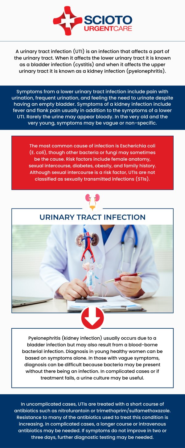 Common questions asked by patients: What is a urinary tract infection (UTI)? What are the signs of a urinary tract infection? What causes a UTI? How is a UTI diagnosed? Can UTIs go away on their own? If you're experiencing a urinary tract infection (UTI), Scioto Urgent Care in Columbus, OH, offers prompt and effective treatment. Our board-certified physician, Dr. William Rothe, M.D., provides personalized care to help relieve symptoms and clear the infection quickly. For more information, contact us now or book an appointment. We are conveniently located at 4760 Sawmill Road Columbus, OH 43235. We serve patients from Columbus OH, Dublin OH, Upper Arlington OH, Hilliard OH, Worthington OH, and surrounding areas. Common questions asked by patients: What is a urinary tract infection (UTI)? What are the signs of a urinary tract infection? What causes a UTI? How is a UTI diagnosed? Can UTIs go away on their own?
If you're experiencing a urinary tract infection (UTI), Scioto Urgent Care in Columbus, OH, offers prompt and effective treatment. Our board-certified physician, Dr. William Rothe, M.D., provides personalized care to help relieve symptoms and clear the infection quickly. For more information, contact us now or book an appointment. We are conveniently located at 4760 Sawmill Road Columbus, OH 43235. We serve patients from Columbus OH, Dublin OH, Upper Arlington OH, Hilliard OH, Worthington OH, and surrounding areas.