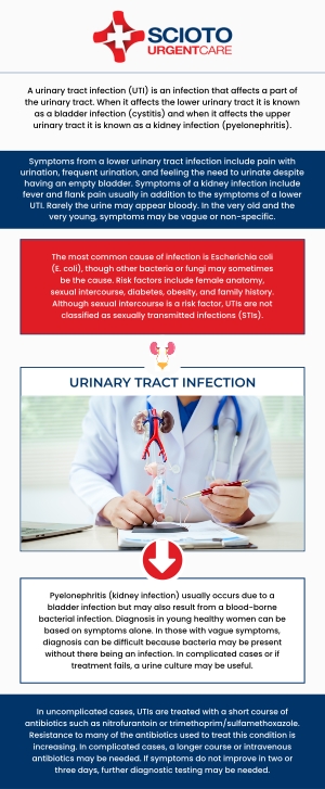 Common questions asked by patients: What is a urinary tract infection (UTI)? What are the signs of a urinary tract infection? What causes a UTI? How is a UTI diagnosed? Can UTIs go away on their own? If you're experiencing a urinary tract infection (UTI), Scioto Urgent Care in Columbus, OH, offers prompt and effective treatment. Our board-certified physician, Dr. William Rothe, M.D., provides personalized care to help relieve symptoms and clear the infection quickly. For more information, contact us now or book an appointment. We are conveniently located at 4760 Sawmill Road Columbus, OH 43235. We serve patients from Columbus OH, Dublin OH, Upper Arlington OH, Hilliard OH, Worthington OH, and surrounding areas. Common questions asked by patients: What is a urinary tract infection (UTI)? What are the signs of a urinary tract infection? What causes a UTI? How is a UTI diagnosed? Can UTIs go away on their own?
If you're experiencing a urinary tract infection (UTI), Scioto Urgent Care in Columbus, OH, offers prompt and effective treatment. Our board-certified physician, Dr. William Rothe, M.D., provides personalized care to help relieve symptoms and clear the infection quickly. For more information, contact us now or book an appointment. We are conveniently located at 4760 Sawmill Road Columbus, OH 43235. We serve patients from Columbus OH, Dublin OH, Upper Arlington OH, Hilliard OH, Worthington OH, and surrounding areas.