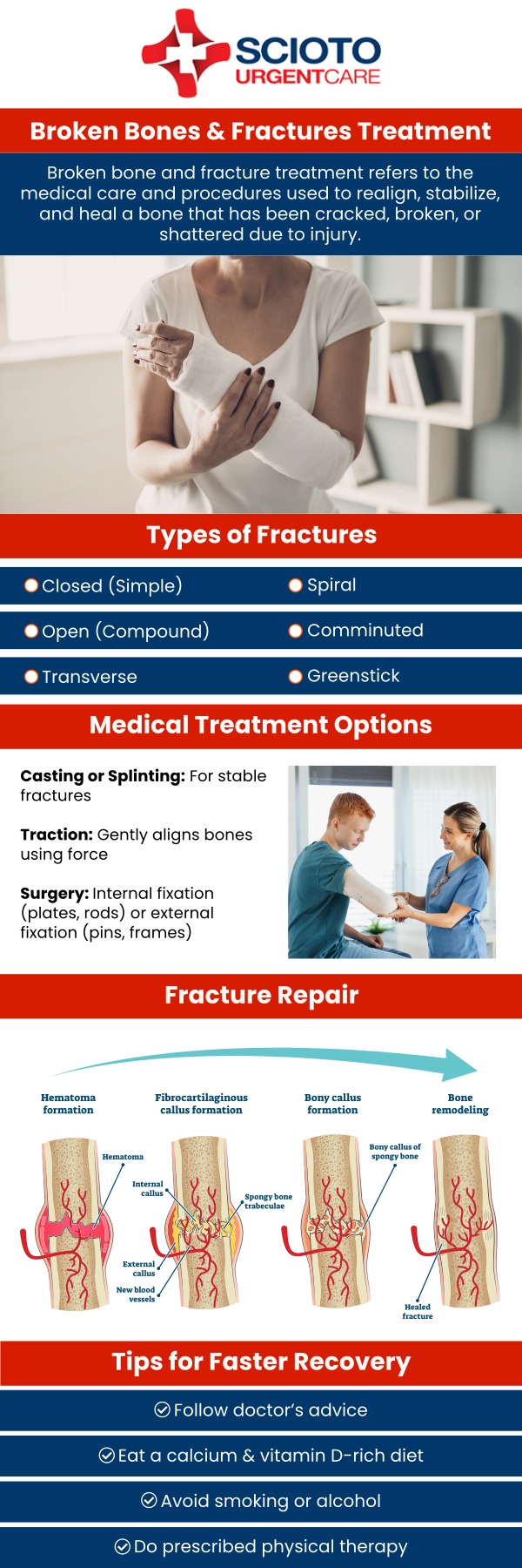 Fractures, whether minor or more complex, require prompt and effective treatment to ensure proper healing. At Scioto Urgent Care in Columbus, OH, we are equipped to handle a variety of bone fractures, from minor breaks to more intricate injuries. Our experienced medical team, led by Dr. William Rothe, offers immediate care, including diagnostic services and fracture treatment, to help you recover quickly and efficiently. For more information, contact us or schedule an appointment online. We are conveniently located at 4760 Sawmill Road Columbus, OH 43235.