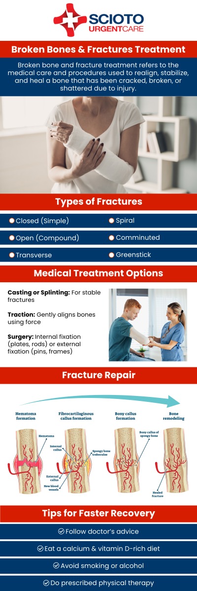 Fractures, whether minor or more complex, require prompt and effective treatment to ensure proper healing. At Scioto Urgent Care in Columbus, OH, we are equipped to handle a variety of bone fractures, from minor breaks to more intricate injuries. Our experienced medical team, led by Dr. William Rothe, offers immediate care, including diagnostic services and fracture treatment, to help you recover quickly and efficiently. For more information, contact us or schedule an appointment online. We are conveniently located at 4760 Sawmill Road Columbus, OH 43235.