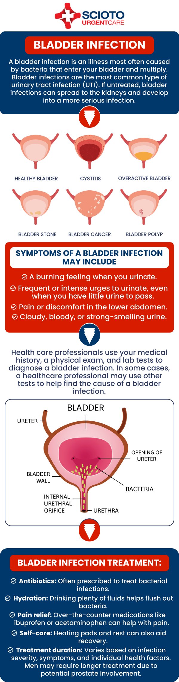 Bladder infections are a common type of urinary tract infection that may cause uncomfortable urinary symptoms and require medical evaluation. Scioto Urgent Care in Columbus, OH, provides care for urinary tract infections, with Board-Certified Dr. William Rothe, M.D., and our medical team offering individualized evaluation and treatment based on each patient’s symptoms and health needs. For more information, contact us or schedule an appointment online. We are conveniently located at 4760 Sawmill Road Columbus, OH 43235. Bladder infections are a common type of urinary tract infection that may cause uncomfortable urinary symptoms and require medical evaluation. Scioto Urgent Care in Columbus, OH, provides care for urinary tract infections, with Board-Certified Dr. William Rothe, M.D., and our medical team offering individualized evaluation and treatment based on each patient’s symptoms and health needs. For more information, contact us or schedule an appointment online. We are conveniently located at 4760 Sawmill Road Columbus, OH 43235.