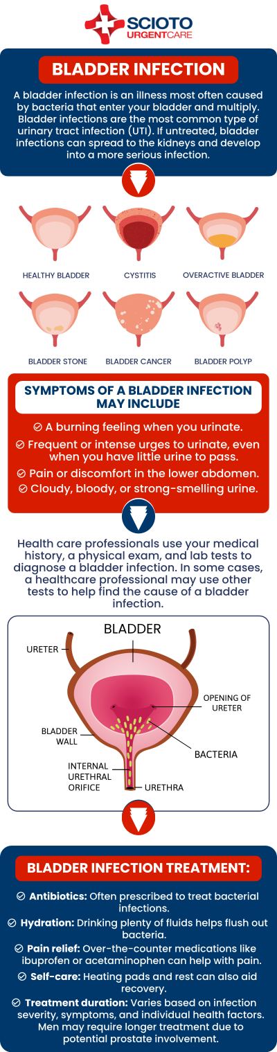 Bladder infections are a common type of urinary tract infection that may cause uncomfortable urinary symptoms and require medical evaluation. Scioto Urgent Care in Columbus, OH, provides care for urinary tract infections, with Board-Certified Dr. William Rothe, M.D., and our medical team offering individualized evaluation and treatment based on each patient’s symptoms and health needs. For more information, contact us or schedule an appointment online. We are conveniently located at 4760 Sawmill Road Columbus, OH 43235. Bladder infections are a common type of urinary tract infection that may cause uncomfortable urinary symptoms and require medical evaluation. Scioto Urgent Care in Columbus, OH, provides care for urinary tract infections, with Board-Certified Dr. William Rothe, M.D., and our medical team offering individualized evaluation and treatment based on each patient’s symptoms and health needs. For more information, contact us or schedule an appointment online. We are conveniently located at 4760 Sawmill Road Columbus, OH 43235.